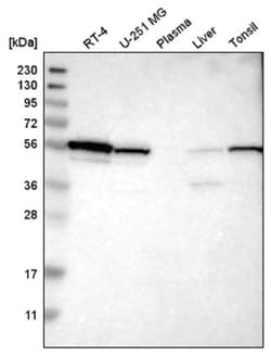 Tryptophanyl tRNA synthetase Antibody, Novus Biologicals:Antibodies:Primary