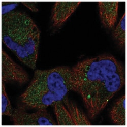 TSC1 Antibody, Novus Biologicals:Antibodies:Primary Antibodies
