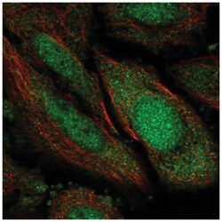 TSNAXIP1 Antibody, Novus Biologicals 100&mu;L; Unlabeled:Antibodies, Polyclonal