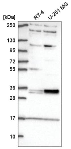 TSPAN11 Antibody, Novus Biologicals 100&mu;L; Unlabeled:Antibodies, Polyclonal