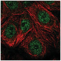TSPAN17 Antibody, Novus Biologicals 100&mu;L; Unlabeled:Antibodies, Polyclonal