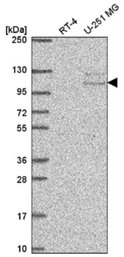 TSR1 Antibody, Novus Biologicals:Antibodies:Primary Antibodies