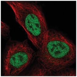 TSSC4 Antibody, Novus Biologicals 100&mu;L; Unlabeled:Antibodies, Polyclonal