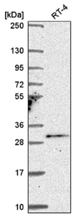 TSSK4 Antibody, Novus Biologicals 100&mu;L; Unlabeled:Antibodies, Polyclonal