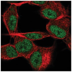 TSTD2 Antibody, Novus Biologicals 25 &mu;L, Unlabeled:Antibodies, Polyclonal
