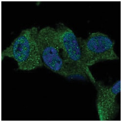 TTBK1 Antibody, Novus Biologicals 25 &mu;L:Antibodies, Polyclonal