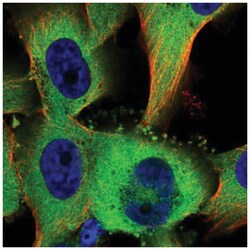TTC1 Antibody, Novus Biologicals:Antibodies:Primary Antibodies