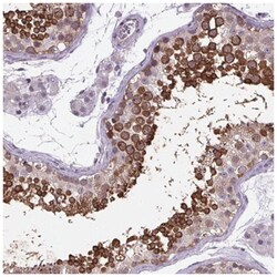TTC12 Antibody, Novus Biologicals:Antibodies:Primary Antibodies