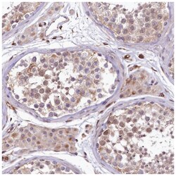 TTC12 Antibody, Novus Biologicals:Antibodies:Primary Antibodies