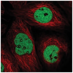 TTC13 Antibody, Novus Biologicals 25 &mu;L, Unlabeled:Antibodies, Polyclonal