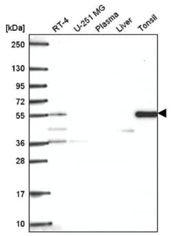TTC39C Antibody, Novus Biologicals:Antibodies:Primary Antibodies