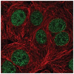 TTC5 Antibody, Novus Biologicals 25 &mu;L:Antibodies, Polyclonal