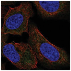 TTF2 Antibody, Novus Biologicals 25 &mu;L, Unlabeled:Antibodies, Polyclonal