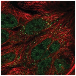 TTI1 Antibody, Novus Biologicals 100&mu;L; Unlabeled:Antibodies, Polyclonal