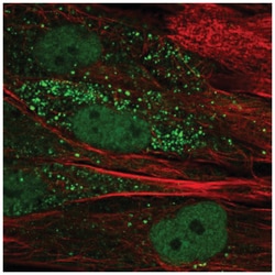 TTL Antibody, Novus Biologicals:Antibodies:Primary Antibodies
