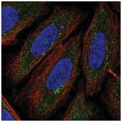 TTPAL Antibody, Novus Biologicals 100&mu;L; Unlabeled:Antibodies, Polyclonal