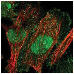 TULP3 Antibody, Novus Biologicals 100&mu;L; Unlabeled:Antibodies, Polyclonal