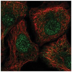 TUT1 Antibody, Novus Biologicals 25 &mu;L, Unlabeled:Antibodies, Polyclonal