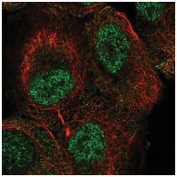 TUT1 Antibody, Novus Biologicals 100&mu;L; Unlabeled:Antibodies, Polyclonal
