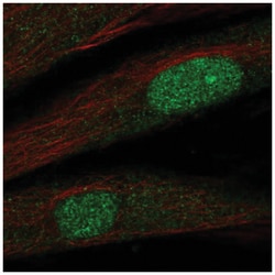 Twist-2 Antibody, Novus Biologicals 100&mu;L; Unlabeled:Antibodies, Polyclonal