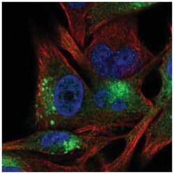 Tyrosinase Antibody, Novus Biologicals 100&mu;L; Unlabeled:Antibodies,