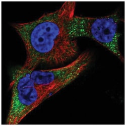 Tyrosinase Antibody, Novus Biologicals 100 &mu;L | Buy Online | Novus Biologicals | Fisher Scientific