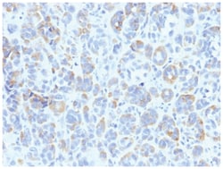 TYRP1 Mouse anti-Human, Mouse, Clone-TYRP1/807, Novus Biologicals:Antibodies:Primary