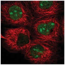 TYW1 Antibody, Novus Biologicals 25 &mu;L, Unlabeled:Antibodies, Polyclonal