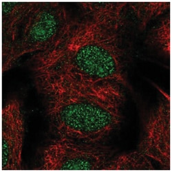 TYW1B Antibody, Novus Biologicals:Antibodies:Primary Antibodies
