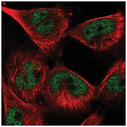 U1A Antibody, Novus Biologicals 100&mu;L; Unlabeled:Anticorps, Polyclonal