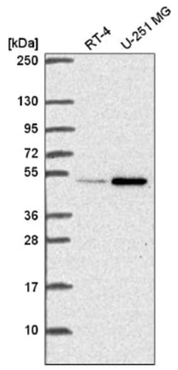 UAP56 Antibody, Novus Biologicals 100&mu;L; Unlabeled:Antibodies, Polyclonal