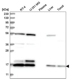 UbcH10/UBE2C Antibody, Novus Biologicals 25 &mu;L, Unlabeled:Antibodies,