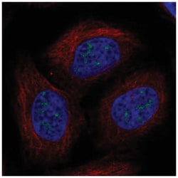UBE2W Antibody, Novus Biologicals 100&mu;L; Unlabeled:Antibodies, Polyclonal