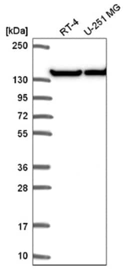 UBE4A Antibody, Novus Biologicals 100&mu;L; Unlabeled:Antibodies, Polyclonal
