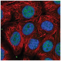 UBFD1 Antibody, Novus Biologicals 25 &mu;L:Antibodies, Polyclonal