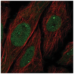 UBN1 Antibody, Novus Biologicals 100&mu;L; Unlabeled:Antibodies, Polyclonal