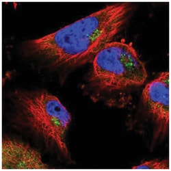 UBPY/USP8 Antibody, Novus Biologicals 100&mu;L; Unlabeled:Antibodies, Polyclonal