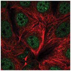 UBR5/EDD Antibody, Novus Biologicals 100&mu;L; Unlabeled:Antibodies, Polyclonal