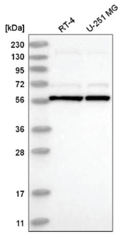 UBXD5 Antibody, Novus Biologicals:Antibodies:Primary Antibodies