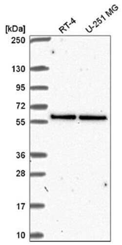 UBXN6 Antibody, Novus Biologicals:Antibodies:Primary Antibodies