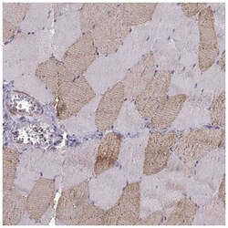 UCP3 Antibody, Novus Biologicals 25 &mu;L; Unlabeled:Antibodies, Polyclonal