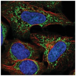 UCP4 Antibody, Novus Biologicals 100&mu;L; Unlabeled:Antibodies, Polyclonal