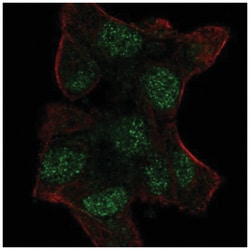 Uev1a/UBE2V1 Antibody, Novus Biologicals 100&mu;L; Unlabeled:Antibodies,