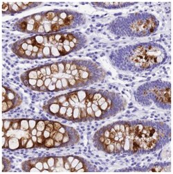 UGT2B4 Antibody, Novus Biologicals:Antibodies:Primary Antibodies