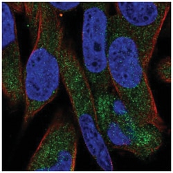 UGT3A1 Antibody, Novus Biologicals 100&mu;L; Unlabeled:Antibodies, Polyclonal