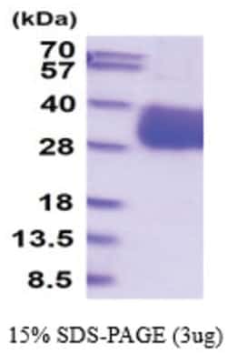 Novus Biologicals&trade;&nbsp;Recombinant Mouse ULBP-4/RAET1E Protein