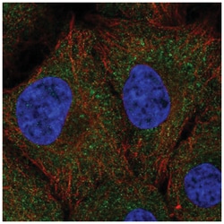 UNKL Antibody, Novus Biologicals 100&mu;L; Unlabeled:Antibodies, Polyclonal
