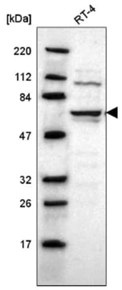 UPF3B Antibody, Novus Biologicals:Antibodies:Primary Antibodies
