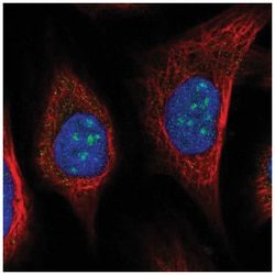 URB2 Antibody, Novus Biologicals 100&mu;L; Unlabeled:Antibodies, Polyclonal
