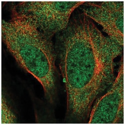 URI Antibody, Novus Biologicals:Antibodies:Primary Antibodies